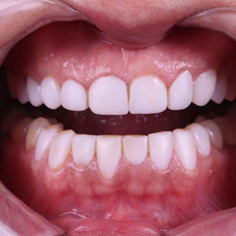 Discover the Power of Real Transformations with the Smile Feed