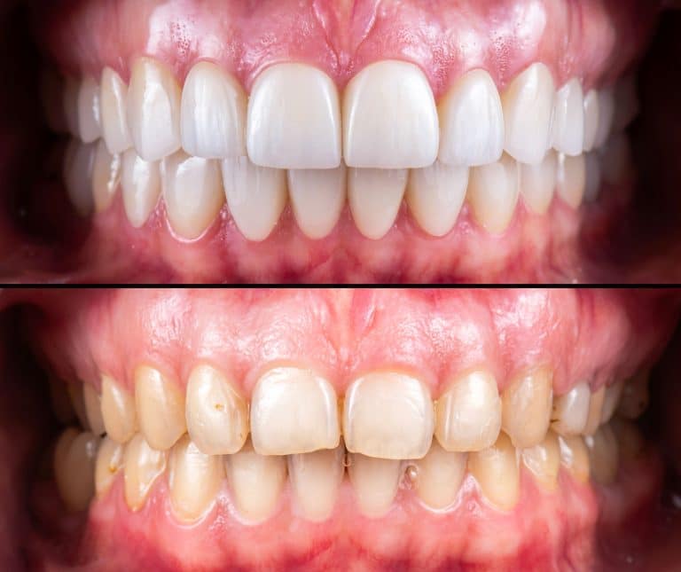 How Verified Before-and-After Dental Cases Transform Patient Decision-Making