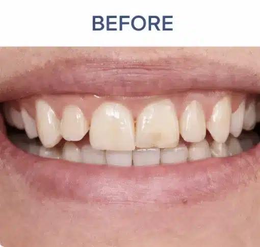 Authentic Results, Real Growth: Why a Verified Case–Focused Dental Network with Education Matters