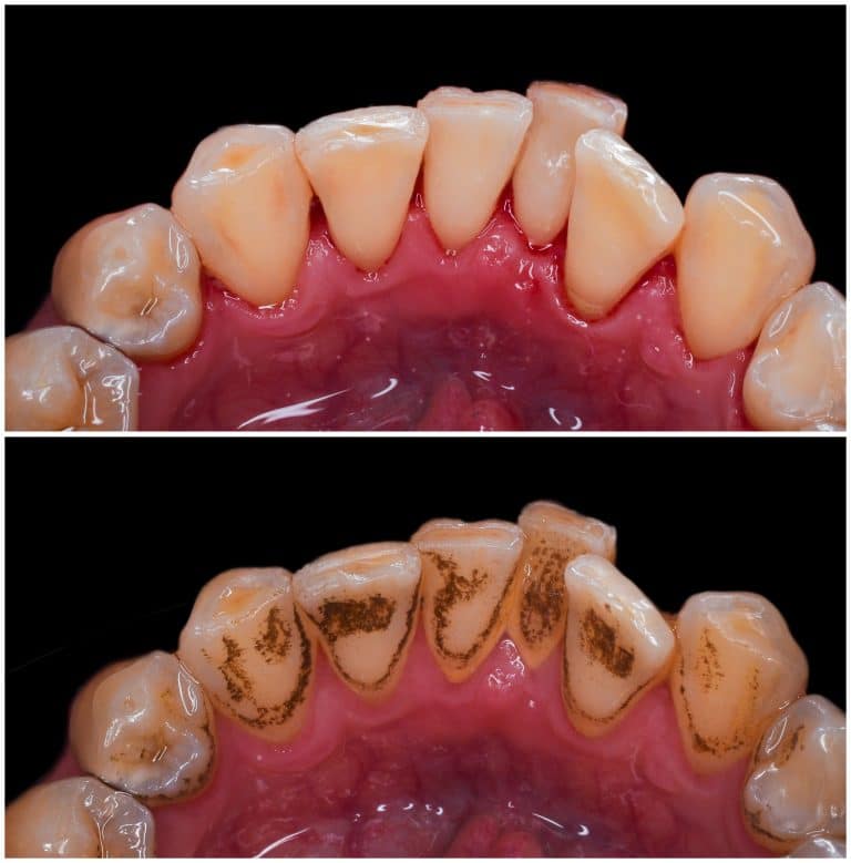How to Evaluate Before-and-After Dental Cases: A Patient Guide to Trust and Transparency
