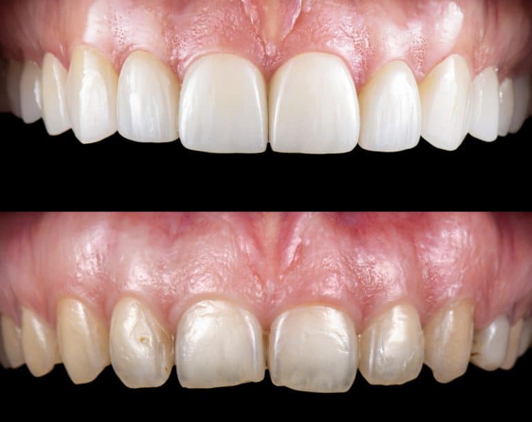 How to Choose the Right Cosmetic Dental Treatment Using Real Smile Results