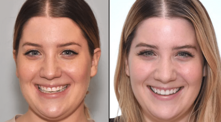 How to Choose a Dentist by Reviewing Real Before-and-After Smile Cases