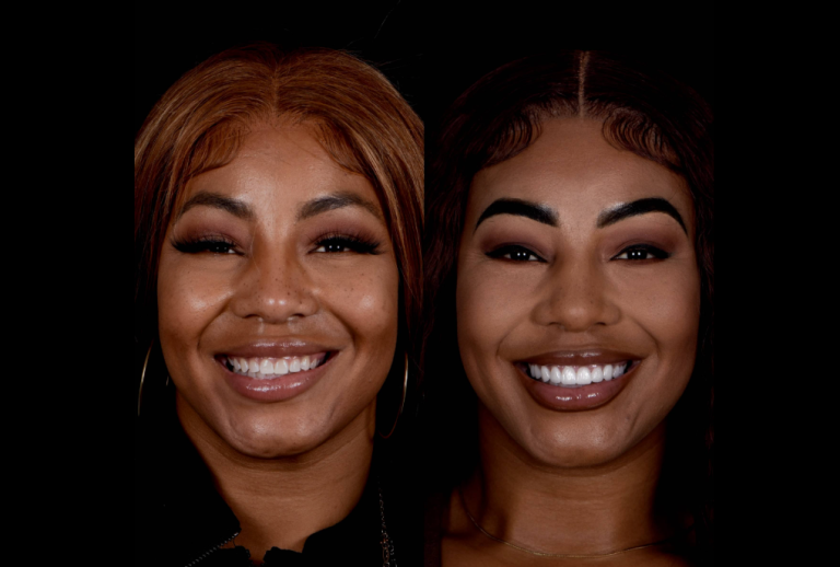 How to Compare Real Smile Transformation Cases Before Choosing a Dentist