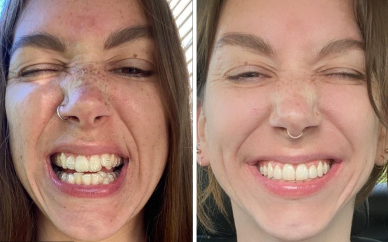 How to Choose a Dentist by Comparing Real Before-and-After Smile Transformations
